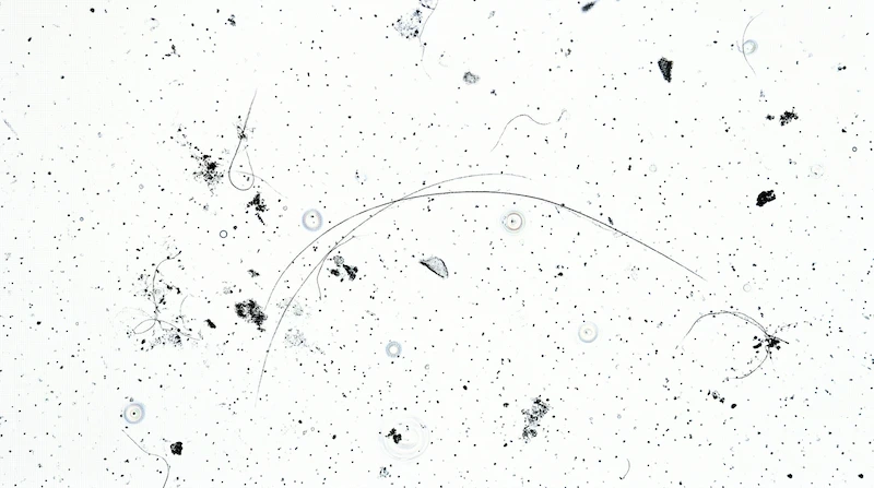 Primer plano macro que muestra polvo y pelusas silueteados contra un fondo de pantalla blanco brillante